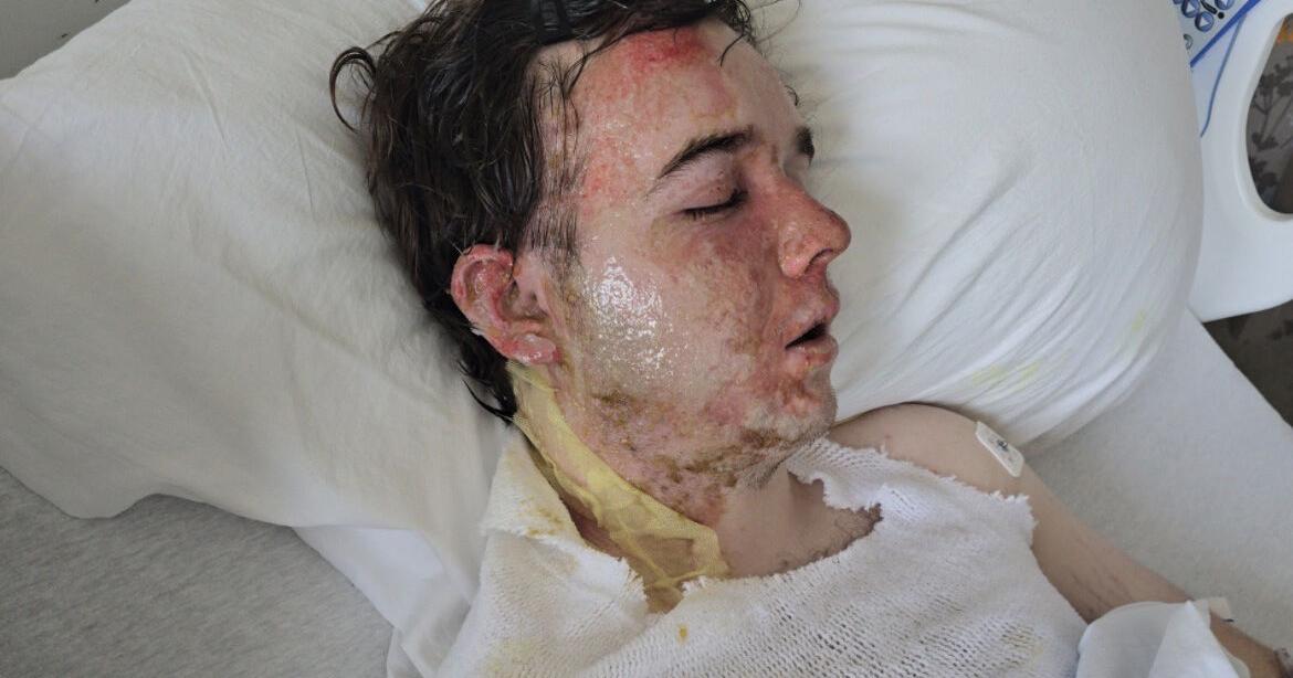 Preliminary hearing scheduled Friday for suspect in Yuba City McDonald’s hot oil incident
