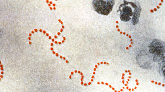 Scarlet fever cases rise, leaving researchers baffled