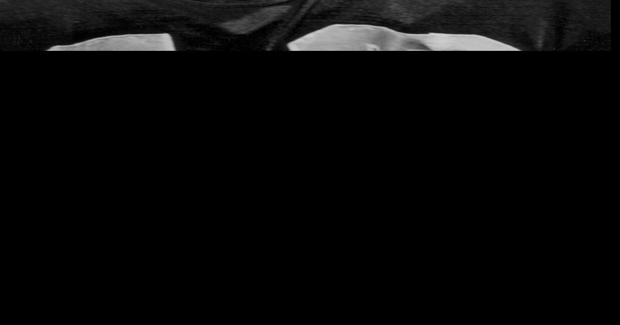 Raiders legend George Atkinson, known for his fierce hits, has died ...