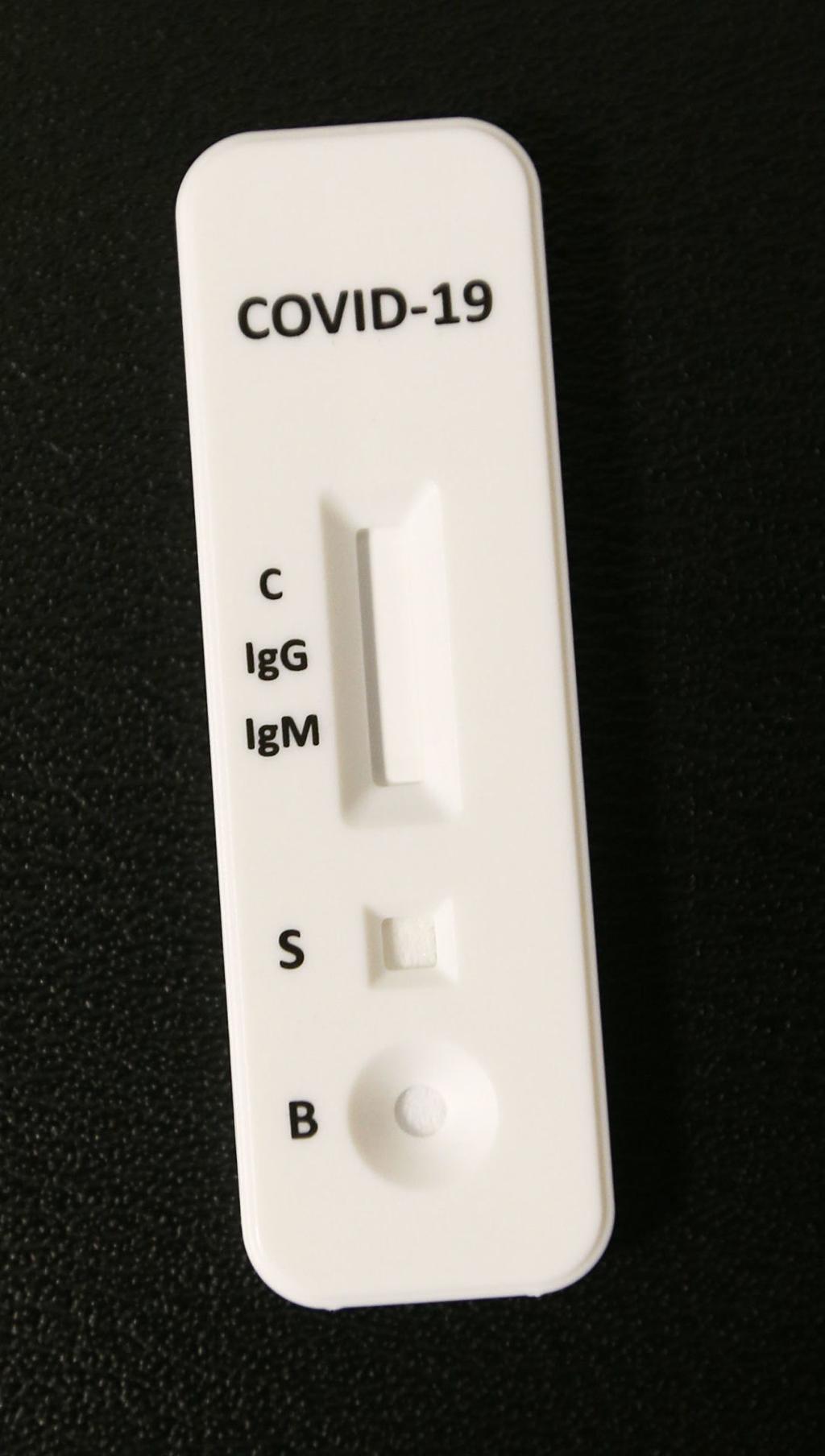 Was It A Cold Flu Or Covid Many Want Access To Antibody Tests