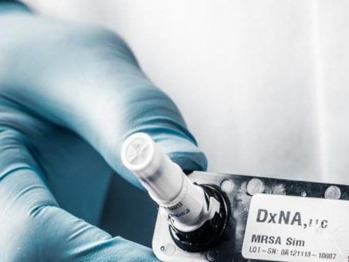 Rapid Detection Dna Test For Valley Fever Clears Fda But Procedure Could Be Uncomfortable For Most Patients Just One Breath Bakersfield Com