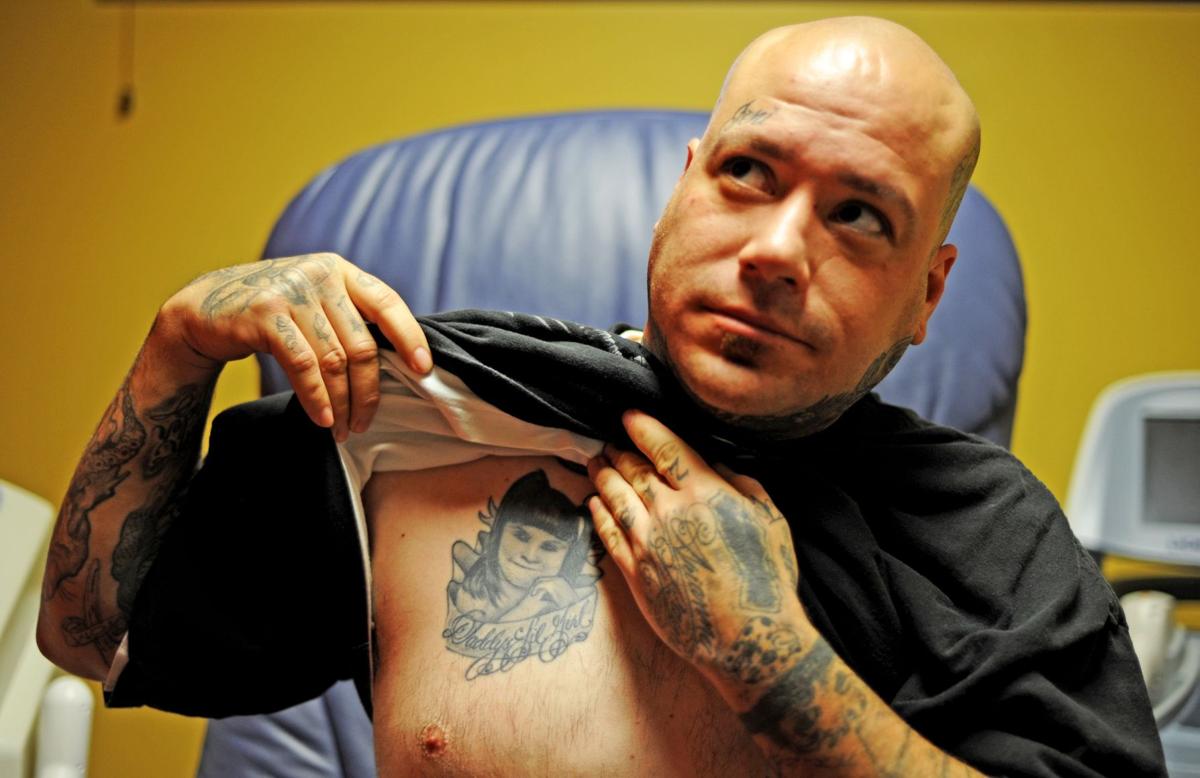 Surgeon Launches Pro Bono Clinic To Laser Away Troublesome Tattoos Archives Bakersfield Com