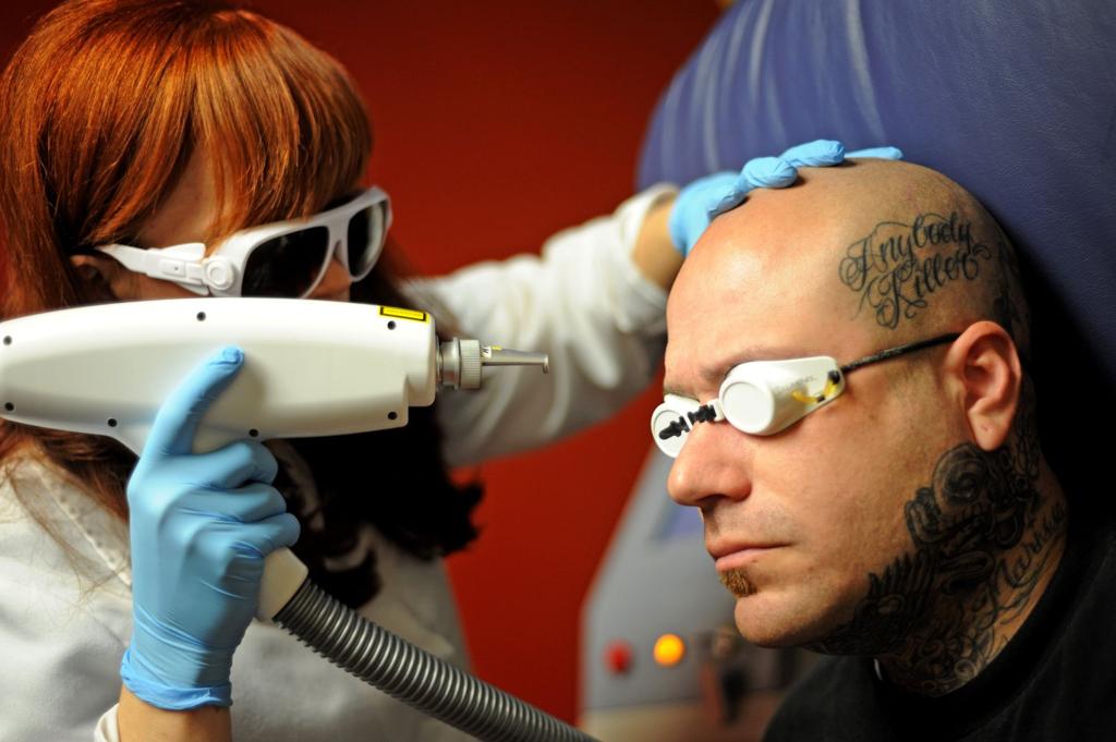Surgeon launches pro-bono clinic to laser away troublesome tattoos |  Archives | bakersfield.com