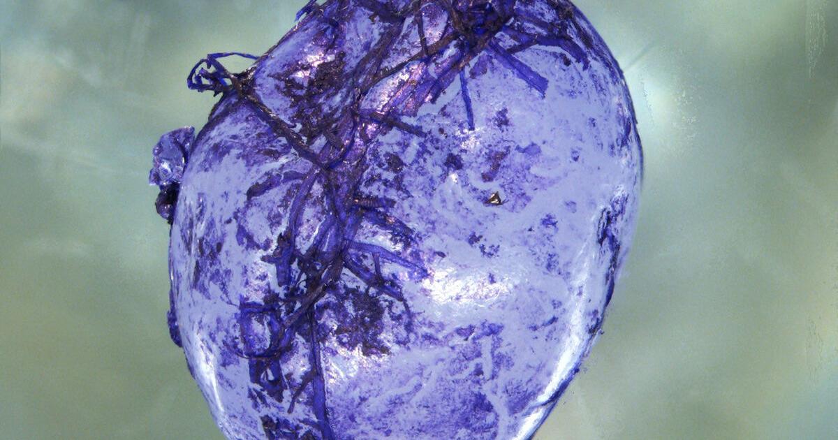 Study: Tiny bacteria could ‘eat’ water-borne microplastics