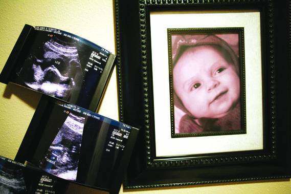 Best way to keep those precious ultrasound photos safe! #babyhacks