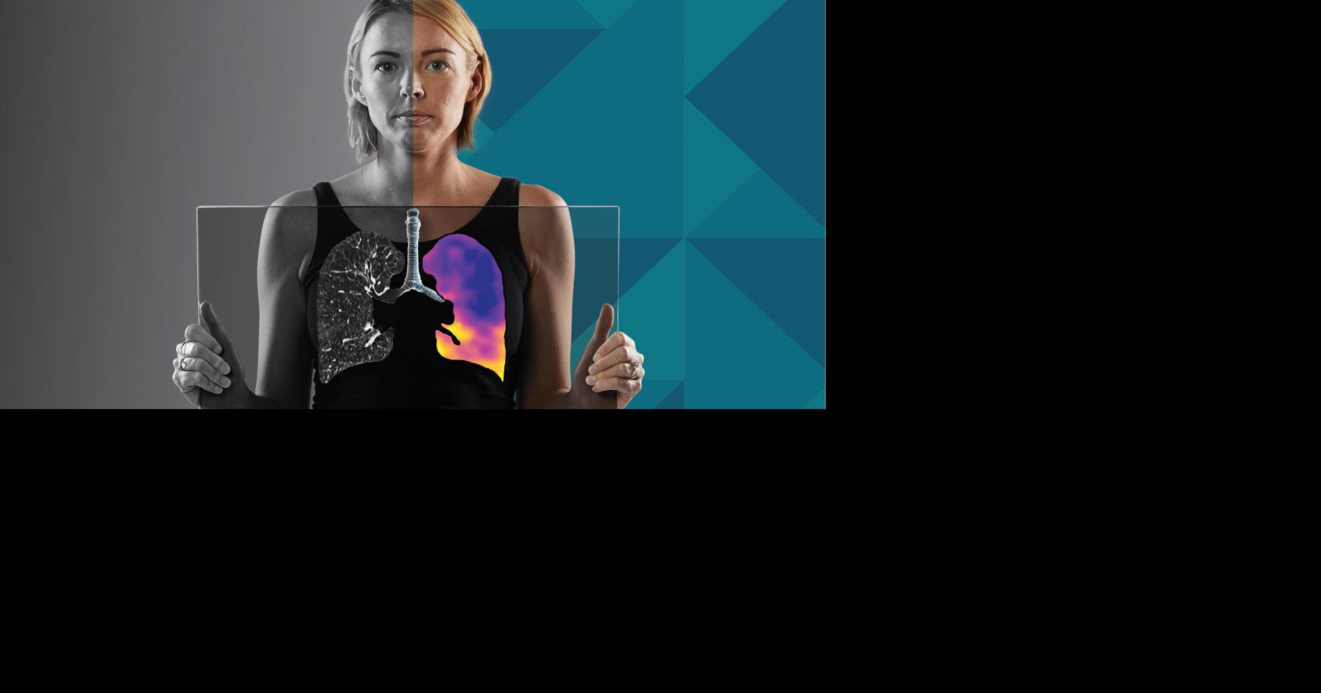 4DMedical Receives TGA Approval for CT:VQ™, Bringing Non-Contrast Ventilation-Perfusion Imaging to Australia
