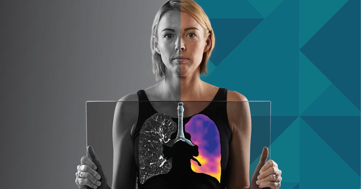 4DMedical Receives TGA Approval for CT:VQ™, Bringing Non-Contrast Ventilation-Perfusion Imaging to Australia