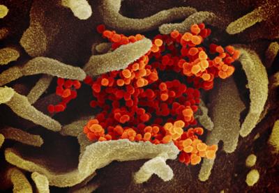 Three New Cases Of Coronavirus Confirmed In Nez Perce County Idaho Bigcountrynewsconnection Com