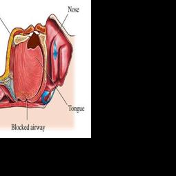 Sleep Better Marysville Expands Sleep Apnea Treatment Services in Marysville, Ohio with Noninvasive Solutions for Obstructive Sleep Apnea Patients