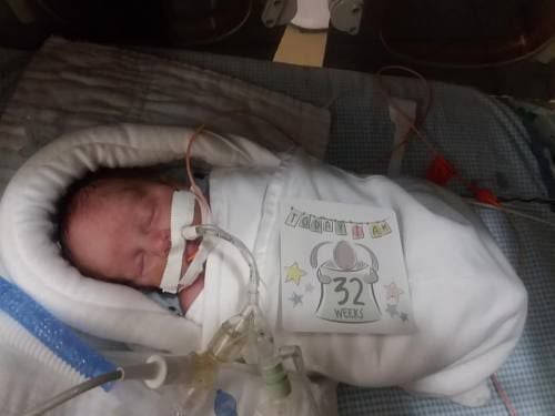 baby born three months early