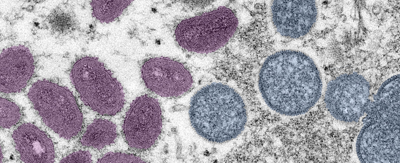 Monkeypox Virus