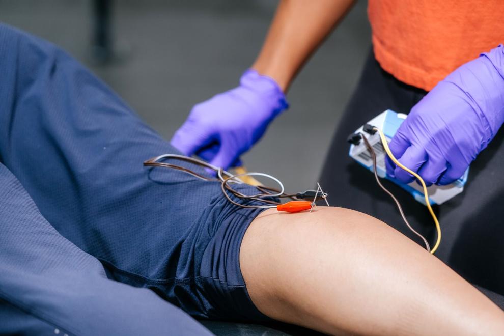 Business Spotlight: What is dry needling? Empower Physiotherapy explains
