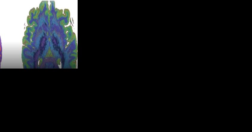 CU researchers one step closer to 3D organ prints - Vimarsana News