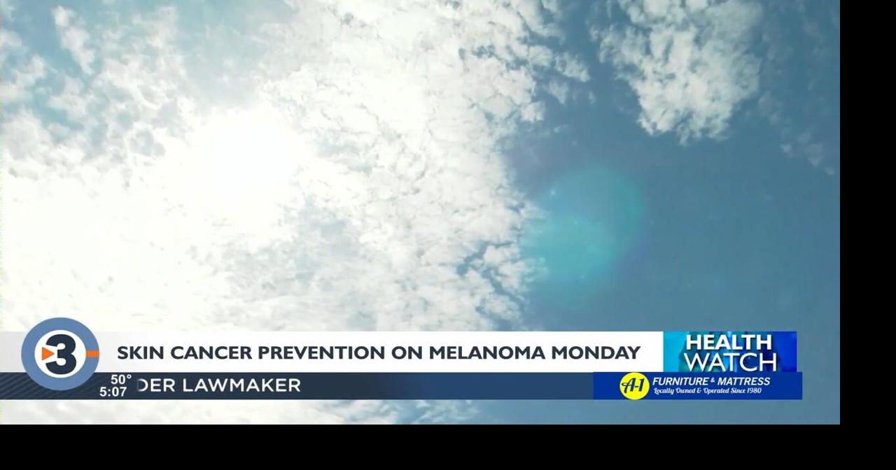 Melanoma Monday aims to raise awareness of skin cancer | News ...