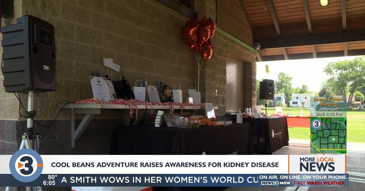 National Kidney Foundation of Wisconsin wraps up fundraiser event - Vimarsana News