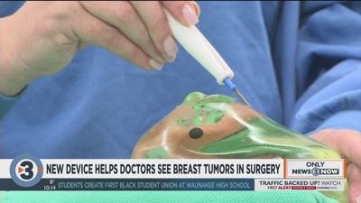 UW-Madison professors create revolutionary GPS device to help surgeons find breast cancer tumors during removal