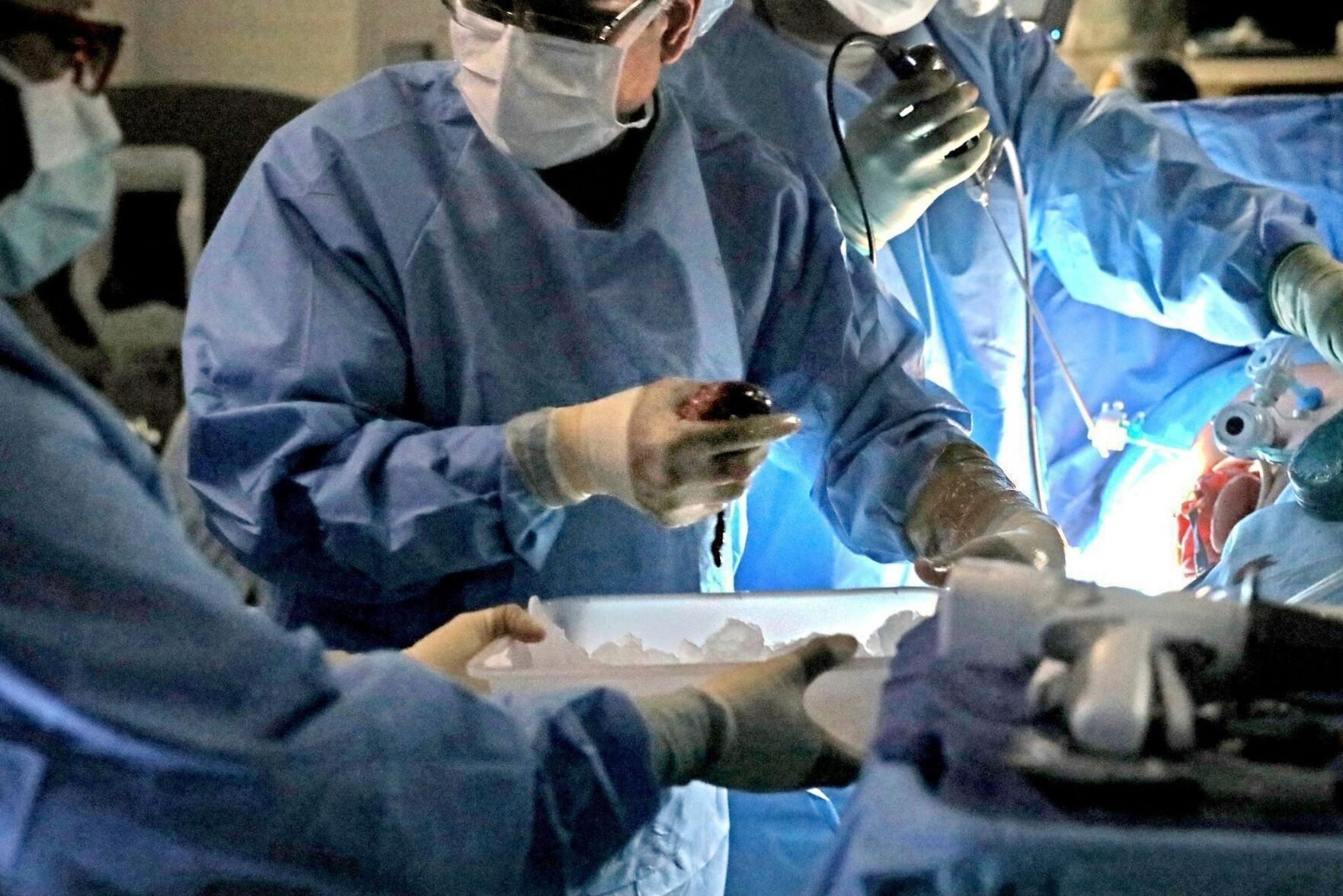 HHS: How we’re fixing the organ transplant system that betrayed America ...