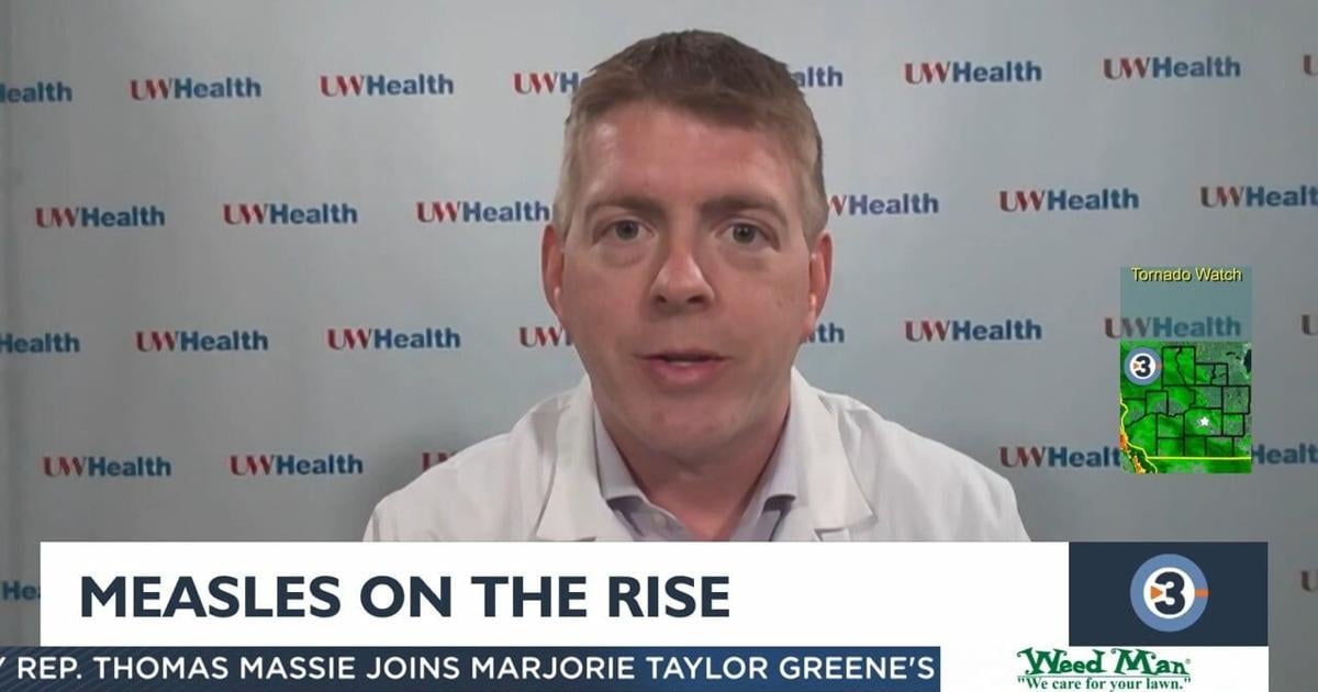 Health Measles on the rise Video channel3000com Channel3000com WISCTV3 Health Measles on the rise Video channel3000com Channel3000com WISCTV3