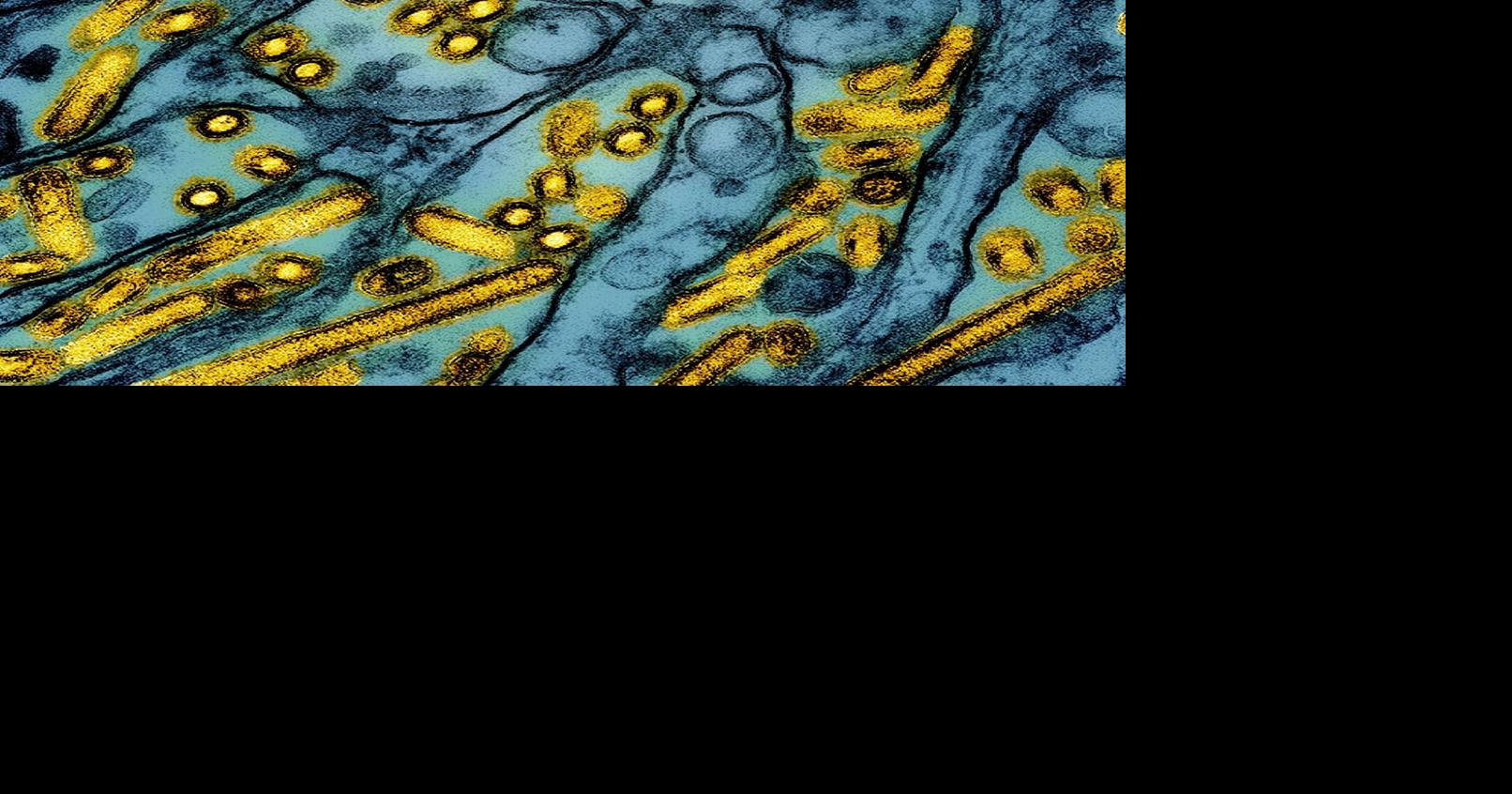 Bird flu case confirmed in Dane County - Channel 3000