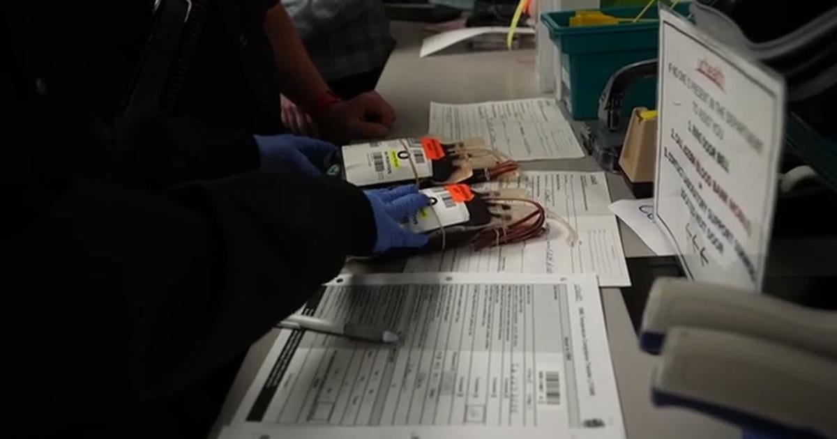 Dead multiple times, saved by trauma team