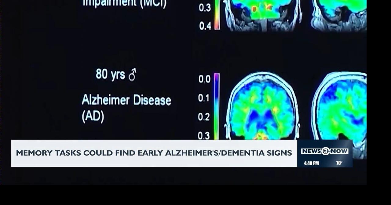 Memory signs could detect early Alzheimer's/dementia signs