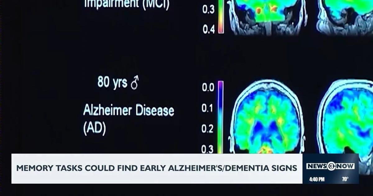 Memory signs could detect early Alzheimer's/dementia signs