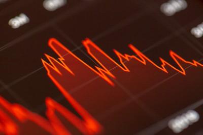 but traders hit pause on the party