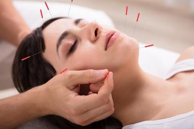 Acupuncture Can Make IVF More Comfortable, Study Says