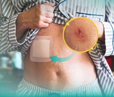 Dimora Silicone Foam Wound Dressings - Make Home Care Easy.