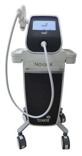 The new Tixel i (for evaporative dry eye and meibomian gland dysfunction) treats upper and lower eyelids of both eyes in less than 2 minutes.