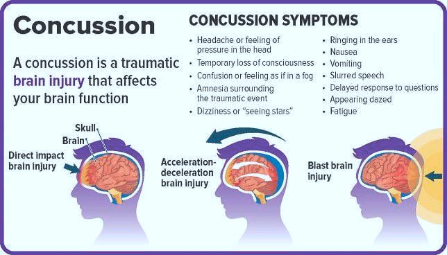 Care For Concussions Life