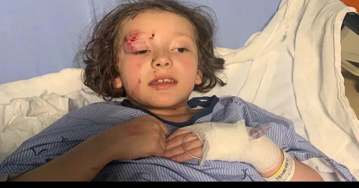 Responses to dog bite fall short. Pet owner, police, city enforcement office should have acted much sooner | Opinion