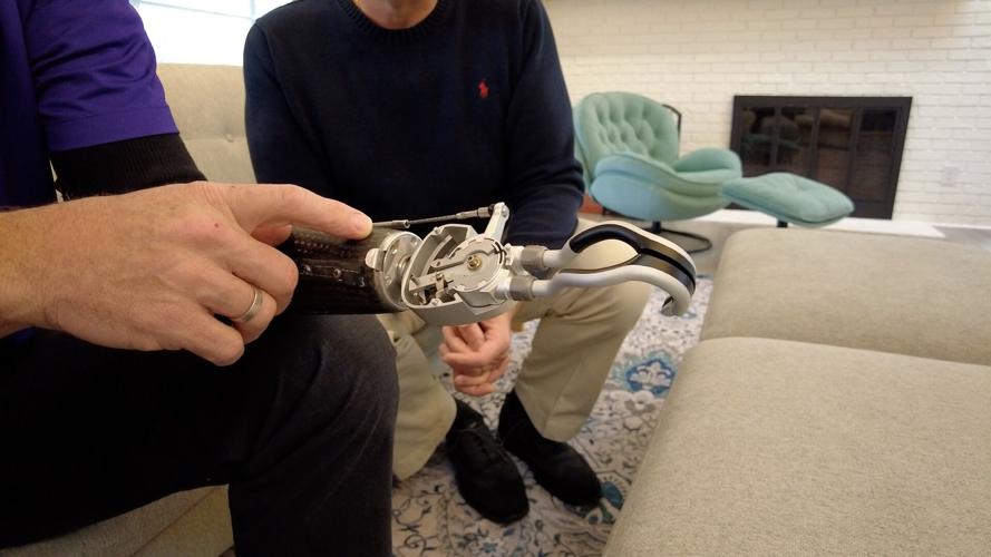 prosthetic arm