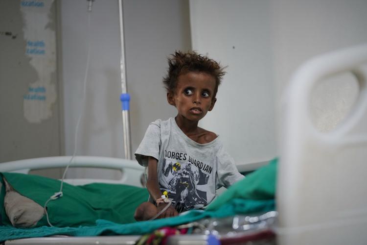 APTOPIX Mideast Wars Yemen