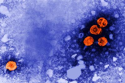 Hepatitis B