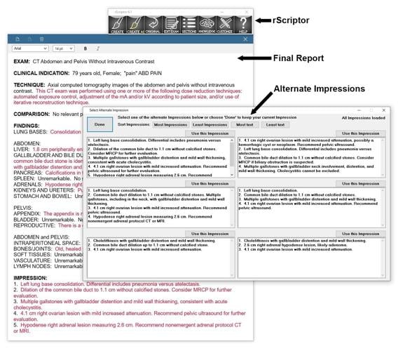 rScriptor Enhances Radiology Workflow With Flexible AI Impression Generation