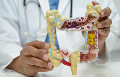 A DOCTOR HOLDS A MEDICAL DIAGRAM OF A COLON 