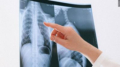 X-Ray