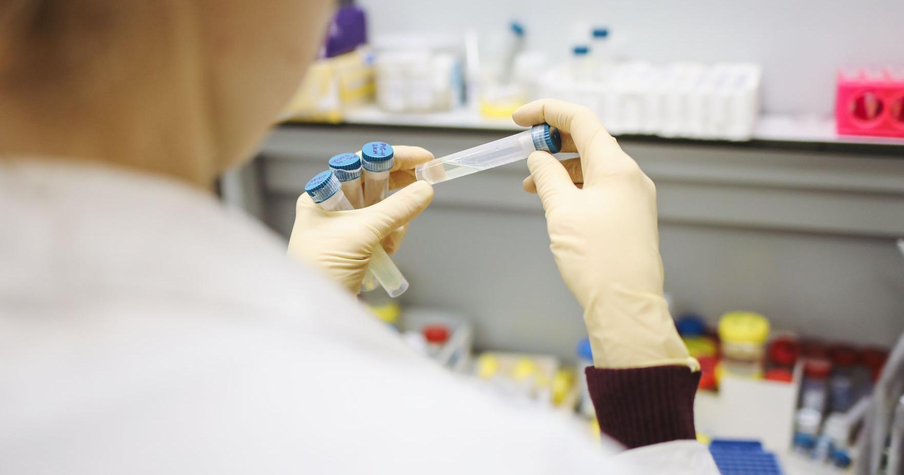 Rabid kitten in Lexington County tests positive for rabies - Vimarsana News