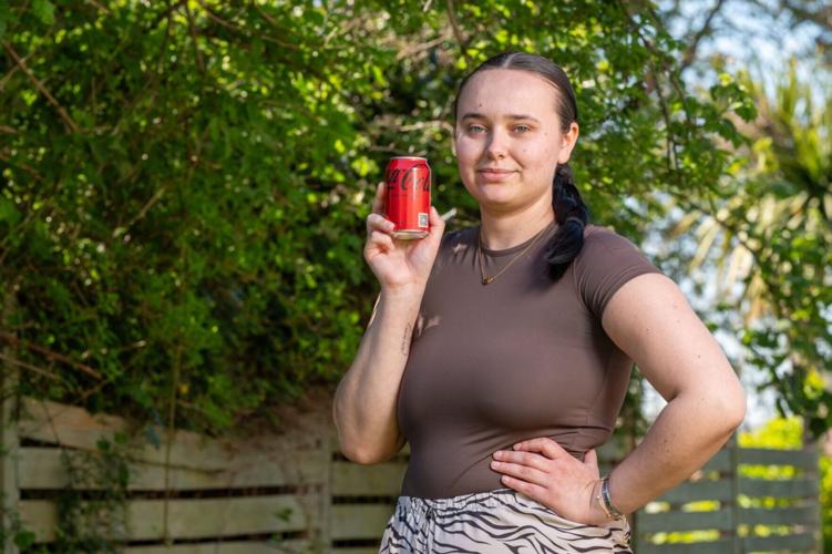 ‘I’ve got no-burp syndrome – I wasn’t able to burp for nearly six years’