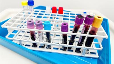 More than 74,000 older adults seek measles immunity tests amid US outbreaks