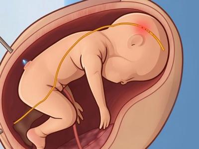 babymonitor_featured