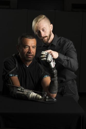 Bionic hand given AI “mind of its own” to make life easier for amputees
