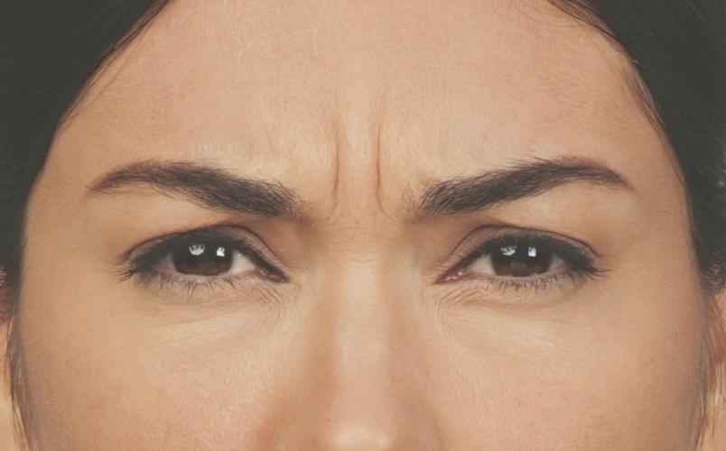 Relax! Lines, tired look are reduced with treatment