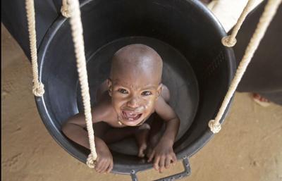 ’Off the charts’: 133k Somalia famine child deaths