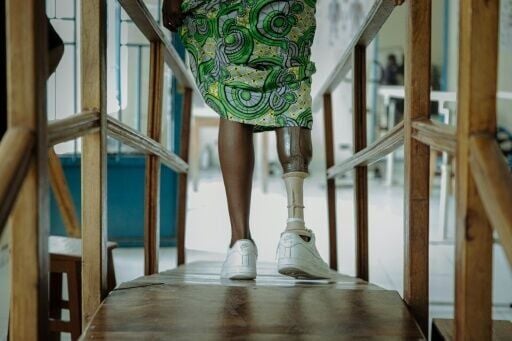 A patient tests her new prosthesis at the Shirika la Umoja centre in Goma