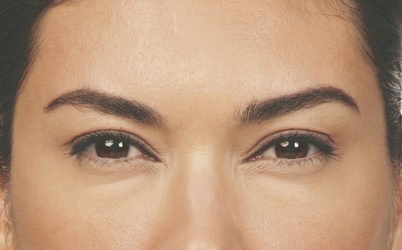 Relax! Lines, tired look are reduced with treatment