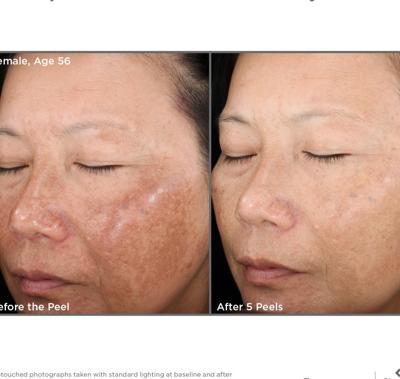 A new you is waiting just beneath the surface