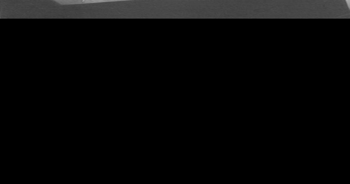 Karen Stock, March 26, 1951 — Nov. 19, 2017 Family obituary