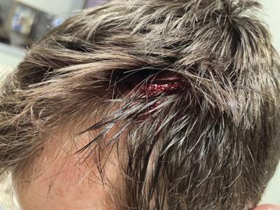 bear wound